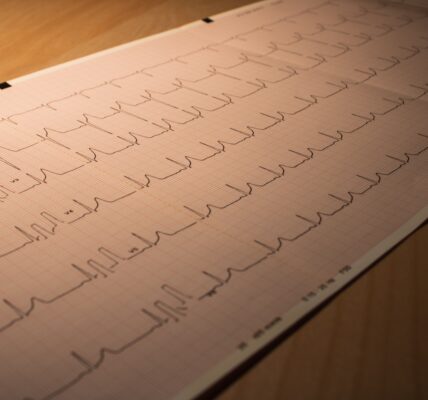 Un corazón acelerado Se considera que tiene una frecuencia cardíaca rápida o taquicardia, con más de 100 latidos por minuto estando en reposo.