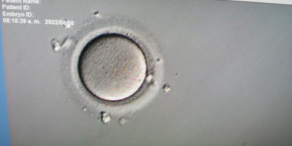 Nutrición ovulatoria: conoce los alimentos que te ayudarán a mejorar la calidad de tus óvulos 14 Ovulo